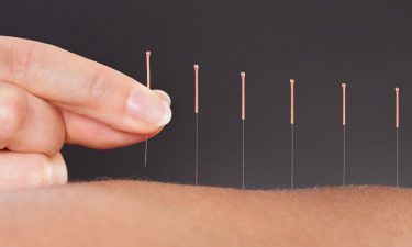 Los secretos de la acupuntura