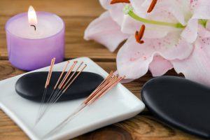 los beneficios de la acupuntura para la salud